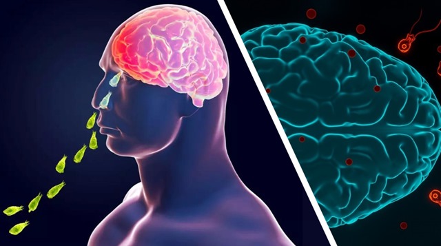 brain eating amoeba
