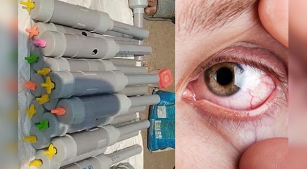 Diwali in Madhya Pradesh 300 children were affected by a carbide gun