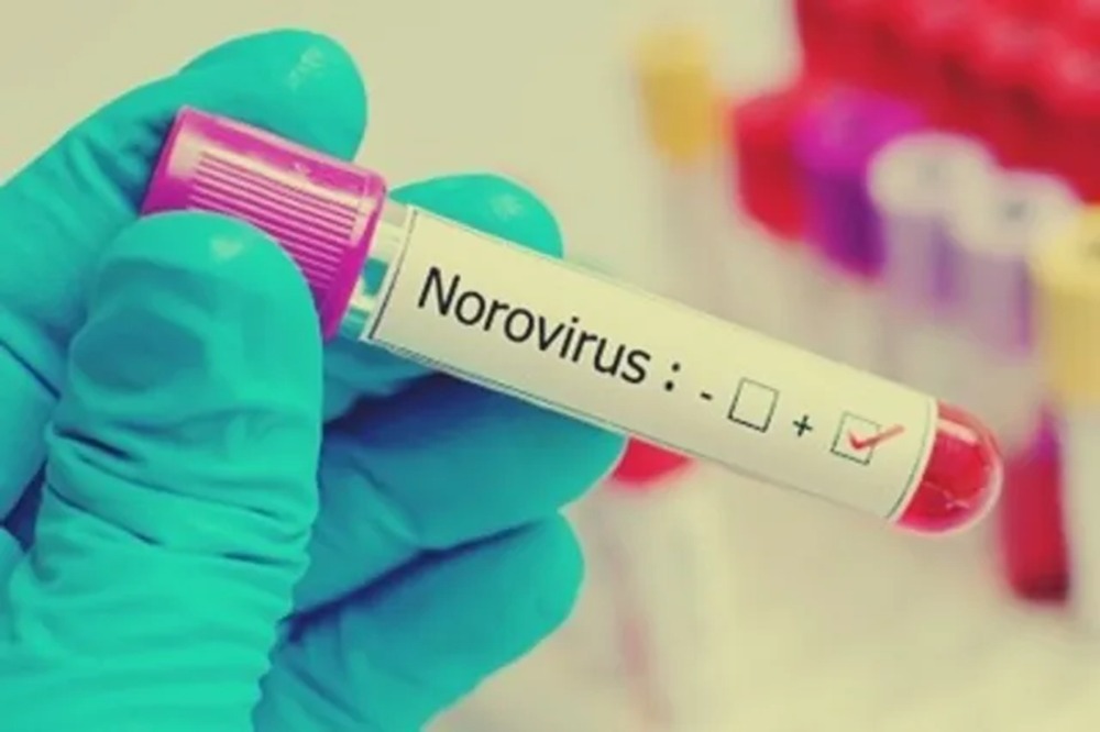 Norovirus